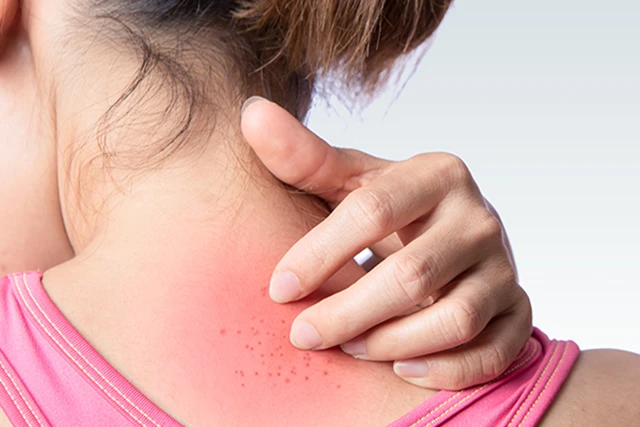 Bà Bầu Bị Ngứa: 12 Mẹo Trị Ngứa Và Nguyên Nhân Gây Nên